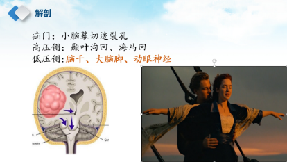 图片 5