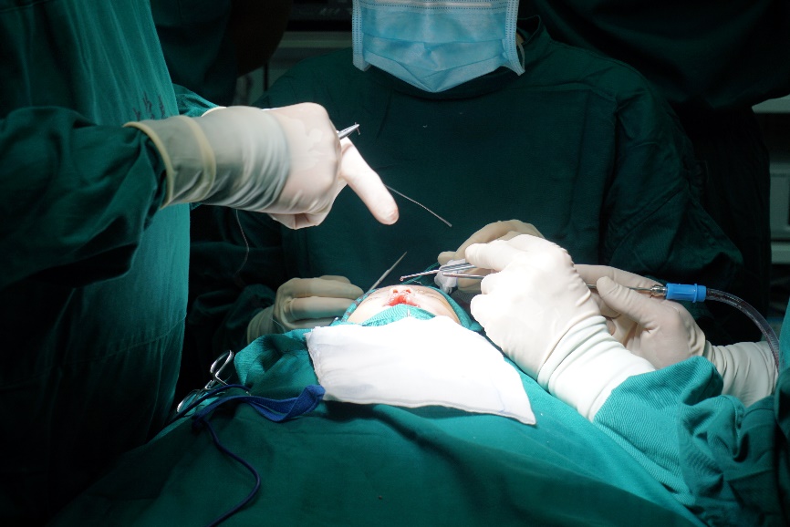 深圳大学总医院口腔科完成一例高难度婴幼儿唇裂整形手术