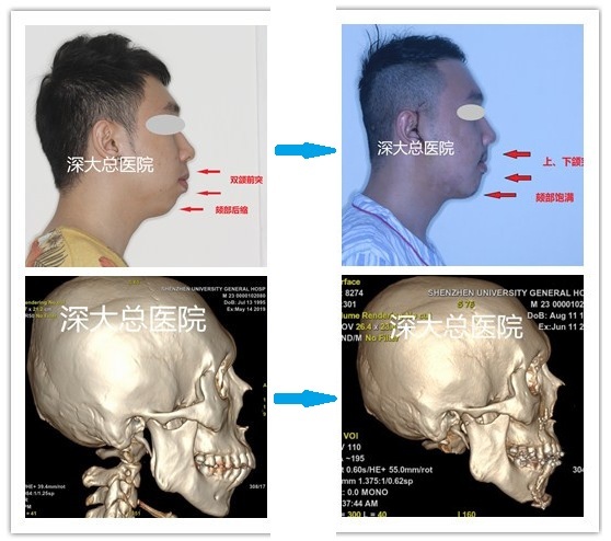 數字化變臉明星臉soeasy