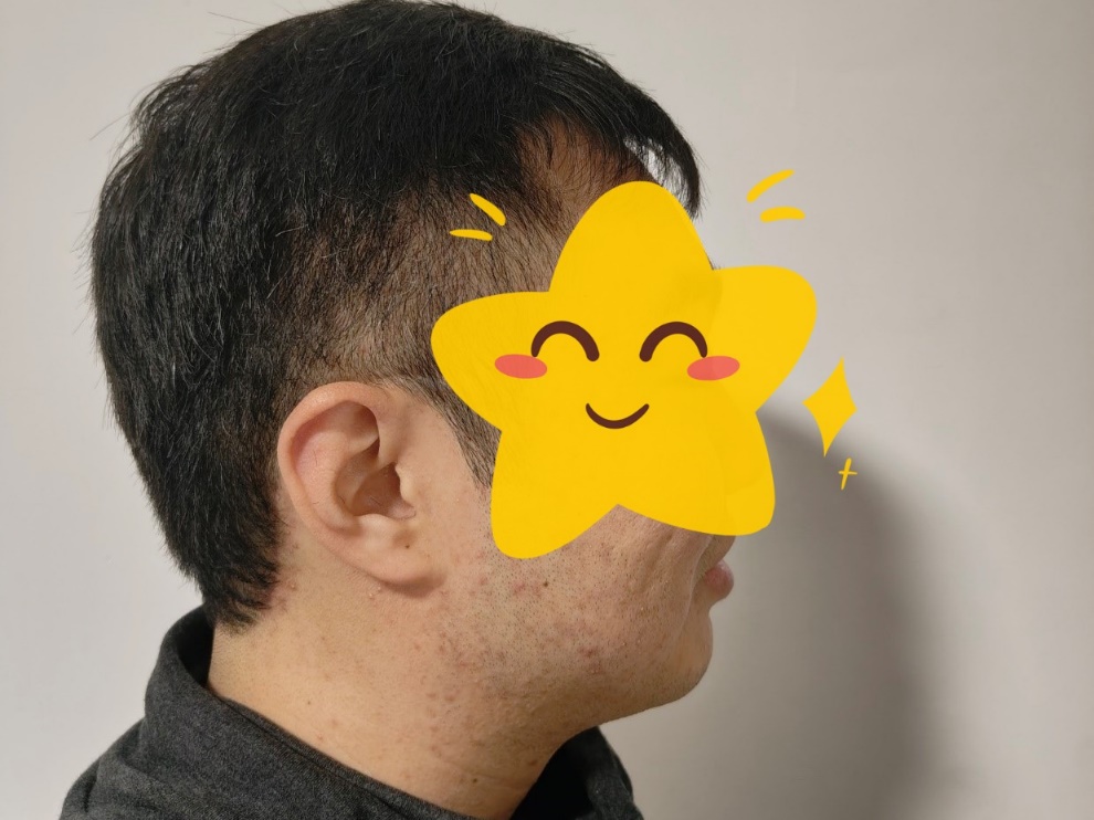 图片 2